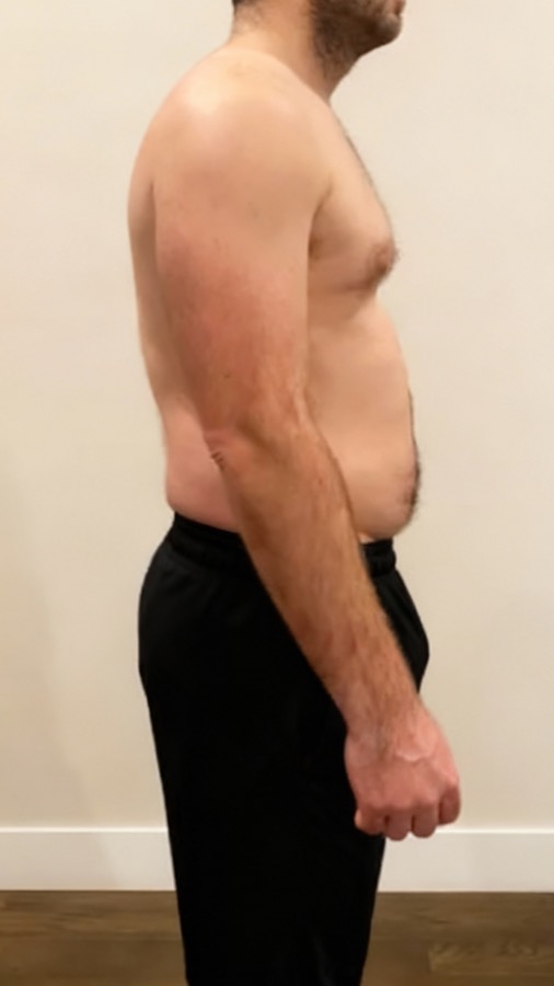 Matt before